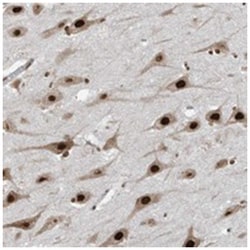 LBH, Rabbit, Polyclonal Antibody, Abnova 100 &mu;L | Buy Online | Abnova Corporation | Fisher Scientific
