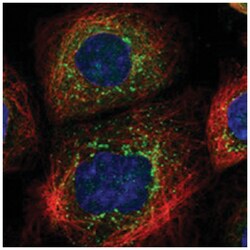 LBH, Rabbit, Polyclonal Antibody, Abnova 100 &mu;L | Buy Online | Abnova Corporation | Fisher Scientific