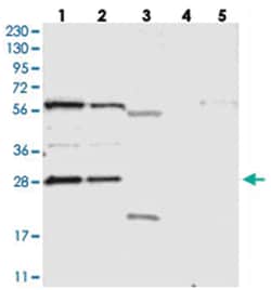 PHOSPHO2, Rabbit, Polyclonal Antibody, Abnova 100 &mu;L | Buy Online | Abnova Corporation | Fisher Scientific