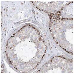 PHOSPHO2, Rabbit, Polyclonal Antibody, Abnova 100 &mu;L | Buy Online | Abnova Corporation | Fisher Scientific