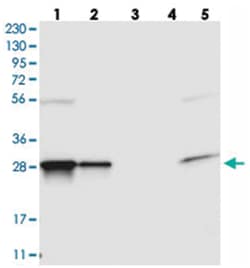 FAM92A1, Rabbit, Polyclonal Antibody, Abnova 100 &mu;L | Buy Online | Abnova Corporation | Fisher Scientific