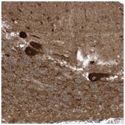 TRIM67, Rabbit, Polyclonal Antibody, Abnova 100 &mu;L | Buy Online | Abnova Corporation | Fisher Scientific