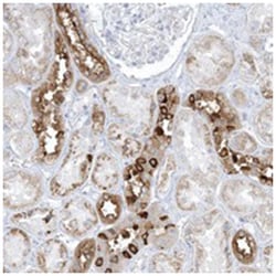 XIRP2, Rabbit, Polyclonal Antibody, Abnova 100 &mu;L | Buy Online | Abnova Corporation | Fisher Scientific