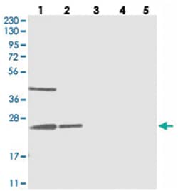 UQCC, Rabbit, Polyclonal Antibody, Abnova 100 &mu;L | Buy Online | Abnova | Fisher Scientific