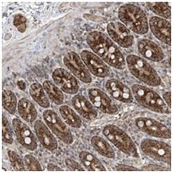 UQCC, Rabbit, Polyclonal Antibody, Abnova 100 &mu;L | Buy Online | Abnova | Fisher Scientific