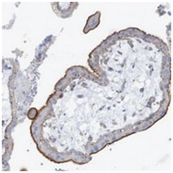 SLC6A12, Rabbit, Polyclonal Antibody, Abnova 100&mu;L; Unlabeled:Antibodies,