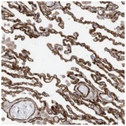 ABCB7 Rabbit anti-Human, Polyclonal Antibody, Abnova 100 &mu;L | Buy Online | Abnova Corporation | Fisher Scientific