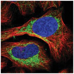 ABCB7 Rabbit anti-Human, Polyclonal Antibody, Abnova 100 &mu;L | Buy Online | Abnova Corporation | Fisher Scientific