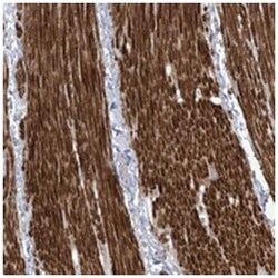 AFTPH, Rabbit, Polyclonal Antibody, Abnova 100 &mu;L | Buy Online | Abnova Corporation | Fisher Scientific