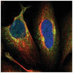 AFTPH, Rabbit, Polyclonal Antibody, Abnova 100 &mu;L | Buy Online | Abnova Corporation | Fisher Scientific