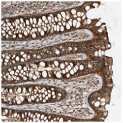 FBLN7, Rabbit, Polyclonal Antibody, Abnova 100 &mu;L | Buy Online | Abnova Corporation | Fisher Scientific