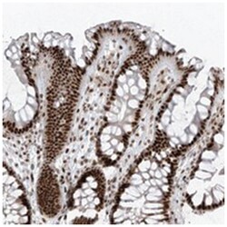 PCNP, Rabbit, Polyclonal Antibody, Abnova 100 &mu;L | Buy Online | Abnova Corporation | Fisher Scientific