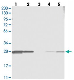C11orf73, Rabbit, Polyclonal Antibody, Abnova 100 &mu;L | Buy Online | Abnova Corporation | Fisher Scientific