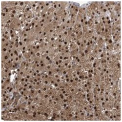 C11orf73, Rabbit, Polyclonal Antibody, Abnova 100 &mu;L | Buy Online | Abnova Corporation | Fisher Scientific
