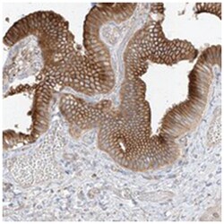 ABHD7, Rabbit, Polyclonal Antibody, Abnova 100 &mu;L | Buy Online | Abnova Corporation | Fisher Scientific