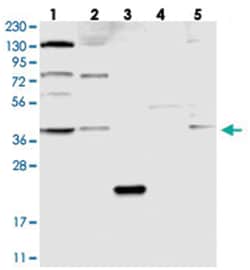 C21orf58, Rabbit, Polyclonal Antibody, Abnova 100 &mu;L | Buy Online | Abnova Corporation | Fisher Scientific