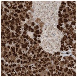 C21orf58, Rabbit, Polyclonal Antibody, Abnova 100 &mu;L | Buy Online | Abnova Corporation | Fisher Scientific