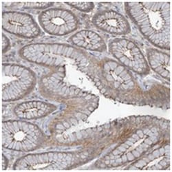SLC9A2, Rabbit, Polyclonal Antibody, Abnova 100 &mu;L | Buy Online | Abnova Corporation | Fisher Scientific