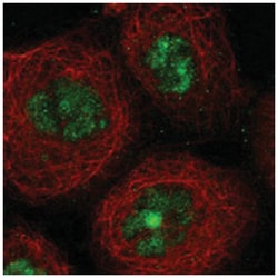 SGOL2, Rabbit, Polyclonal Antibody, Abnova 100&mu;L; Unlabeled:Antibodies,