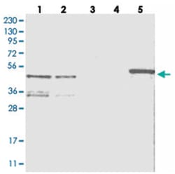 ZNF641, Rabbit, Polyclonal Antibody, Abnova 100&mu;L; Unlabeled:Antibodies,
