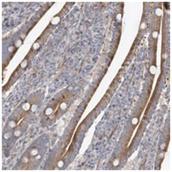 ZNF641, Rabbit, Polyclonal Antibody, Abnova 100&mu;L; Unlabeled:Antibodies,