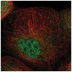 ZNF641, Rabbit, Polyclonal Antibody, Abnova 100&mu;L; Unlabeled:Antibodies,