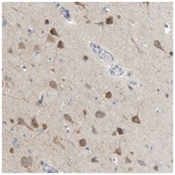 CCDC14, Rabbit, Polyclonal Antibody, Abnova 100 &mu;L | Buy Online | Abnova Corporation | Fisher Scientific