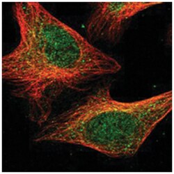 DPH3, Rabbit, Polyclonal Antibody, Abnova 100 &mu;L | Buy Online | Abnova Corporation | Fisher Scientific