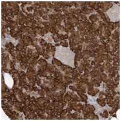 MAGIX, Rabbit, Polyclonal Antibody, Abnova 100 &mu;L | Buy Online | Abnova Corporation | Fisher Scientific