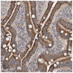 METTL18, Rabbit, Polyclonal Antibody, Abnova 100 &mu;L | Buy Online | Abnova Corporation | Fisher Scientific