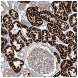 SCGB1D2, Rabbit, Polyclonal Antibody, Abnova 100 &mu;L | Buy Online | Abnova Corporation | Fisher Scientific