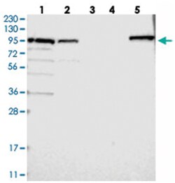 RASA2, Rabbit, Polyclonal Antibody, Abnova 100&mu;L; Unlabeled:Antibodies,