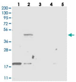 THNSL2, Rabbit, Polyclonal Antibody, Abnova 100 &mu;L | Buy Online | Abnova Corporation | Fisher Scientific