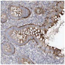 THNSL2, Rabbit, Polyclonal Antibody, Abnova 100 &mu;L | Buy Online | Abnova Corporation | Fisher Scientific