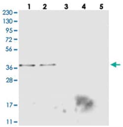 MTHFD2L, Rabbit, Polyclonal Antibody, Abnova 100&mu;L; Unlabeled:Antibodies,