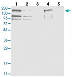 EHBP1 Rabbit anti-Human, Polyclonal Antibody, Abnova 100&mu;L; Unlabeled:Antibodies,