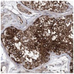 EHBP1 Rabbit anti-Human, Polyclonal Antibody, Abnova 100&mu;L; Unlabeled:Antibodies,