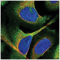 EHBP1 Rabbit anti-Human, Polyclonal Antibody, Abnova 100&mu;L; Unlabeled:Antibodies,