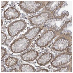 ADAT2, Rabbit, Polyclonal Antibody, Abnova 100&mu;L; Unlabeled:Antibodies,