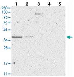 SLC35A5, Rabbit, Polyclonal Antibody, Abnova 100&mu;L; Unlabeled:Antibodies,