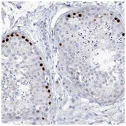 SLC35A5, Rabbit, Polyclonal Antibody, Abnova 100&mu;L; Unlabeled:Antibodies,