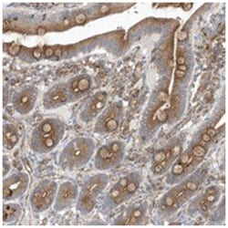 OTOP1, Rabbit, Polyclonal Antibody, Abnova 100 &mu;L | Buy Online | Abnova Corporation | Fisher Scientific