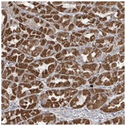 HDDC2, Rabbit, Polyclonal Antibody, Abnova 100 &mu;L | Buy Online | Abnova Corporation | Fisher Scientific
