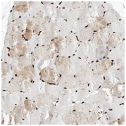 LEAP2, Rabbit, Polyclonal Antibody, Abnova 100&mu;L; Unlabeled:Antibodies,