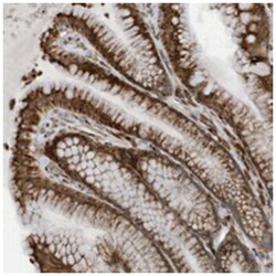 ZBTB45, Rabbit, Polyclonal Antibody, Abnova 100&mu;L; Unlabeled:Antibodies,