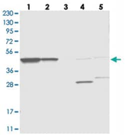 OLA1, Rabbit, Polyclonal Antibody, Abnova 100 &mu;L | Buy Online | Abnova Corporation | Fisher Scientific