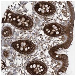 OLA1, Rabbit, Polyclonal Antibody, Abnova 100 &mu;L | Buy Online | Abnova Corporation | Fisher Scientific