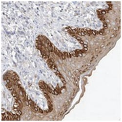 ALS2CR12, Rabbit, Polyclonal Antibody, Abnova 100 &mu;L | Buy Online | Abnova Corporation | Fisher Scientific