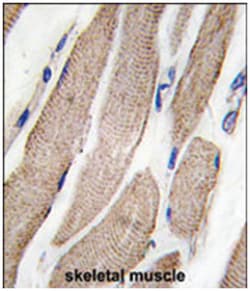 MAP2K5 Rabbit anti-Human, Polyclonal Antibody, Abnova 400 &mu;L | Buy Online | Abnova Corporation | Fisher Scientific