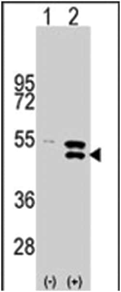 MAP2K5 Rabbit anti-Human, Polyclonal Antibody, Abnova 400 &mu;L | Buy Online | Abnova Corporation | Fisher Scientific